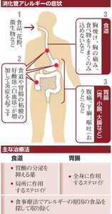 消化管アレルギーの症状/主な治療法