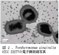 図2電子顕微鏡写真