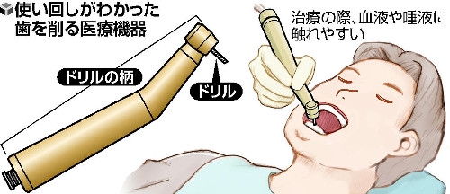 画像：使い回しがわかった歯を削る医療機器