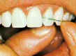 Floss between each tooth