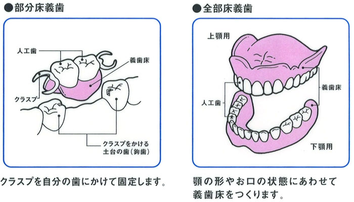 義歯ケアの基礎知識